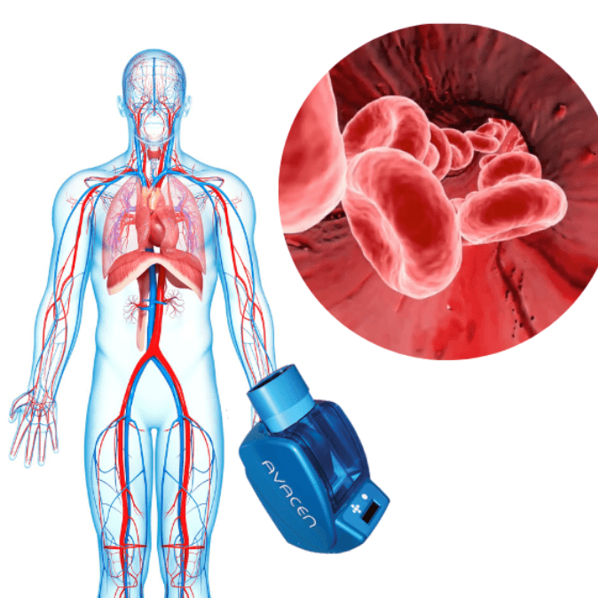 Terapia Circulatoria AVACEN